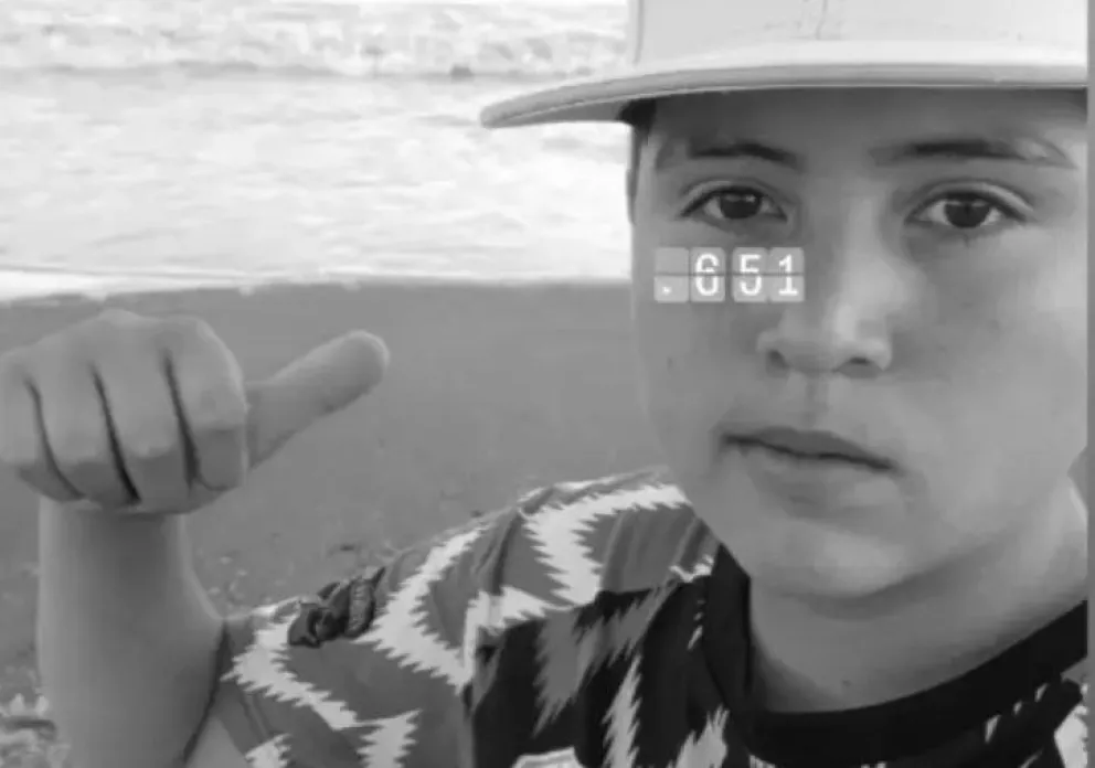  A una semana del accidente de Lucas, el joven que se cayó de la moto en Viedma: cómo está su cuadro médico 
