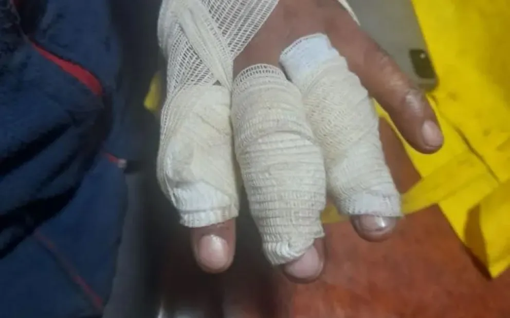 Se incendió una casilla en la toma Unión y una persona sufrió quemaduras de tercer grado