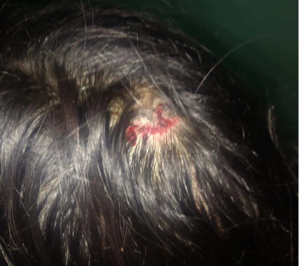 Delincuentes robaron en una despensa y lastimaron a dos chicas