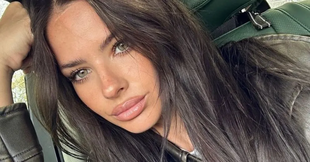 La China Suárez mostró una fuerte herida que sufrió tras un accidente doméstico