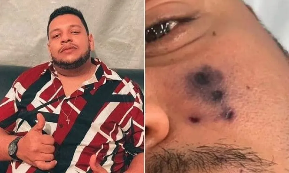 Trágica muerte de un cantante brasileño por la picadura de una araña