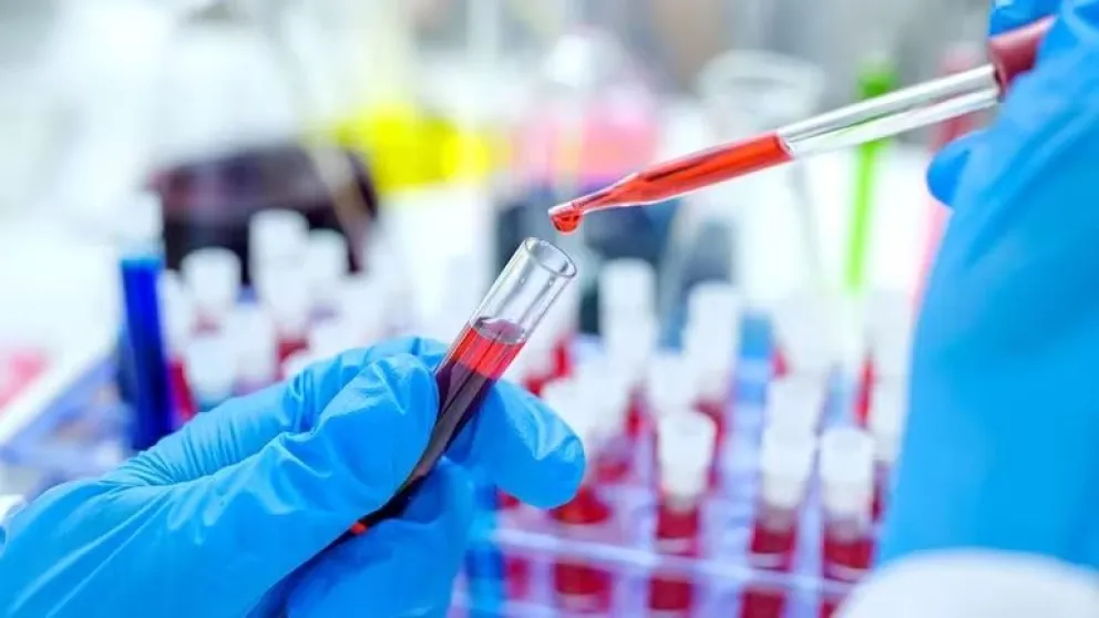 Día Mundial de la lucha contra el Sida: la importancia de un control a tiempo para tratar la enfermedad 