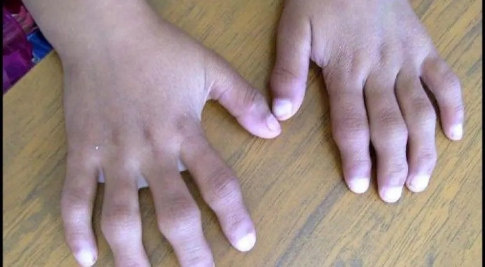 Necesitan la ayuda de los vecinos para llevar a su hijo a un especialista