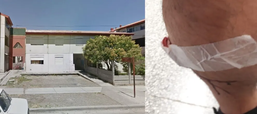 Un menor baleó a un hombre en Las 1016 Viviendas: "Me efectuó tres tiros con un arma de fuego, por la espalda"