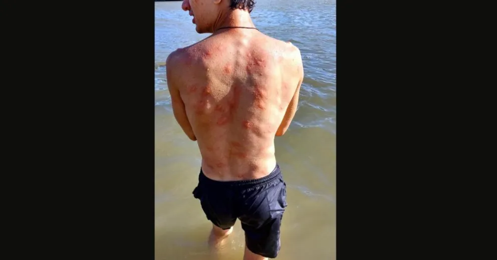 Una imagen impactante: así quedó luego de 15 minutos en el río