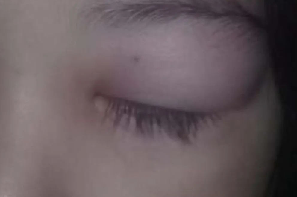 Mosquitos intratables: crece el malestar y hubo muchas huidas de la playa y del río por estos zancudos