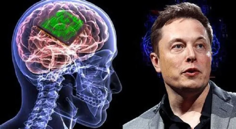 Elon Musk anunció que su empresa implantó exitosamente el primer chip cerebral en un humano 