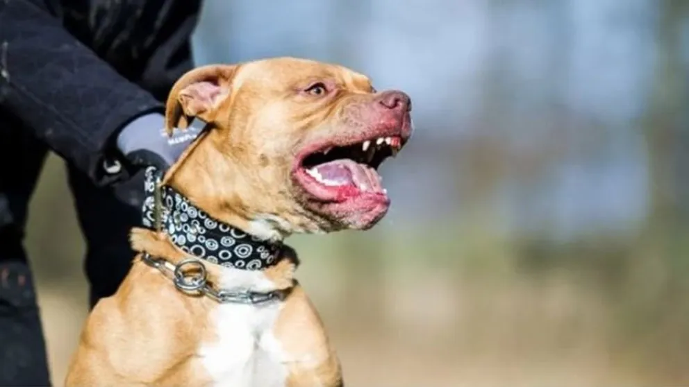 Lucha por su vida: una nena fue atacada por un pitbull