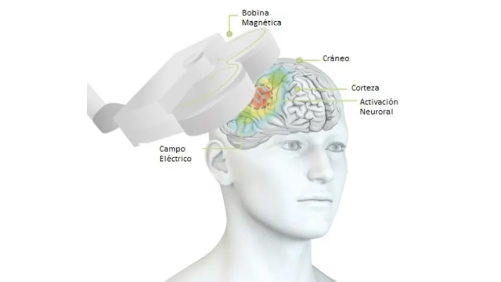 Investigan los beneficios de la estimulación magnética transcraneal para tratar el Asperger 