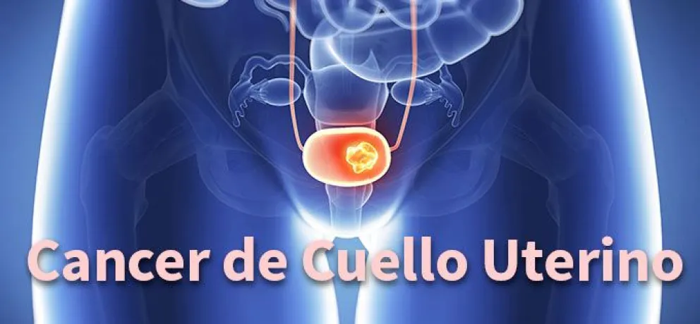 Campaña PAP en Carmen de Patagones: Prevención del cáncer cérvico uterino