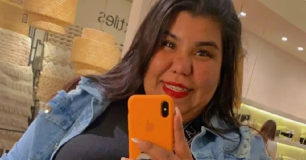 Impactantes cambios de Camila, hermana de Thiago de GH, tras someterse a tratamiento estético