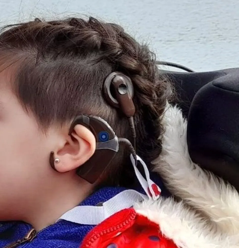 En Patagones, una nena perdió el procesador que le permite escuchar: “Es parte importantísima para su recuperación”