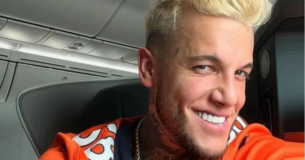 La impactante transformación de Alex Caniggia en su rostro: así quedó ahora