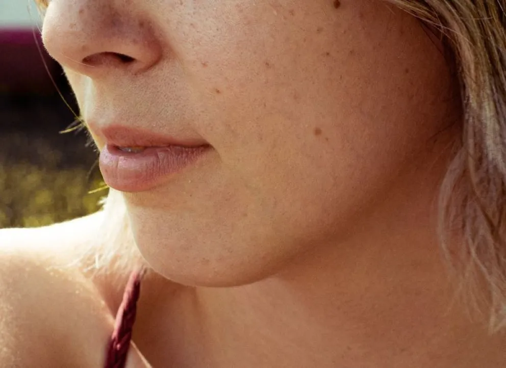 Dermatología integral: Un nuevo enfoque en el cuidado de la piel