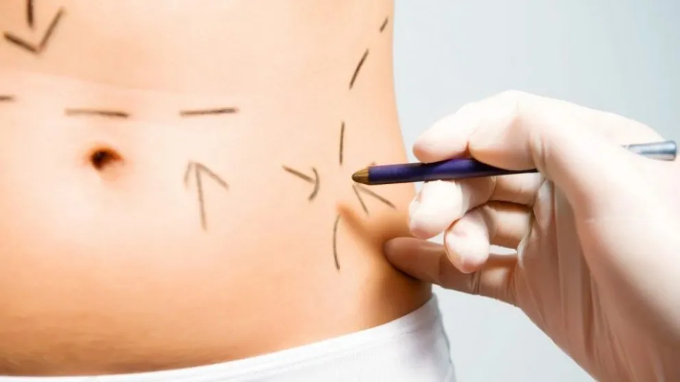 Cirugías plásticas: las preferencias estéticas en aumento en Viedma