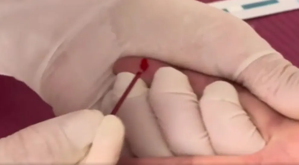 Como en el Hot Sale, agentes de El Galpón ofrecieron tres testeos rápidos a cambio de un pinchazo 