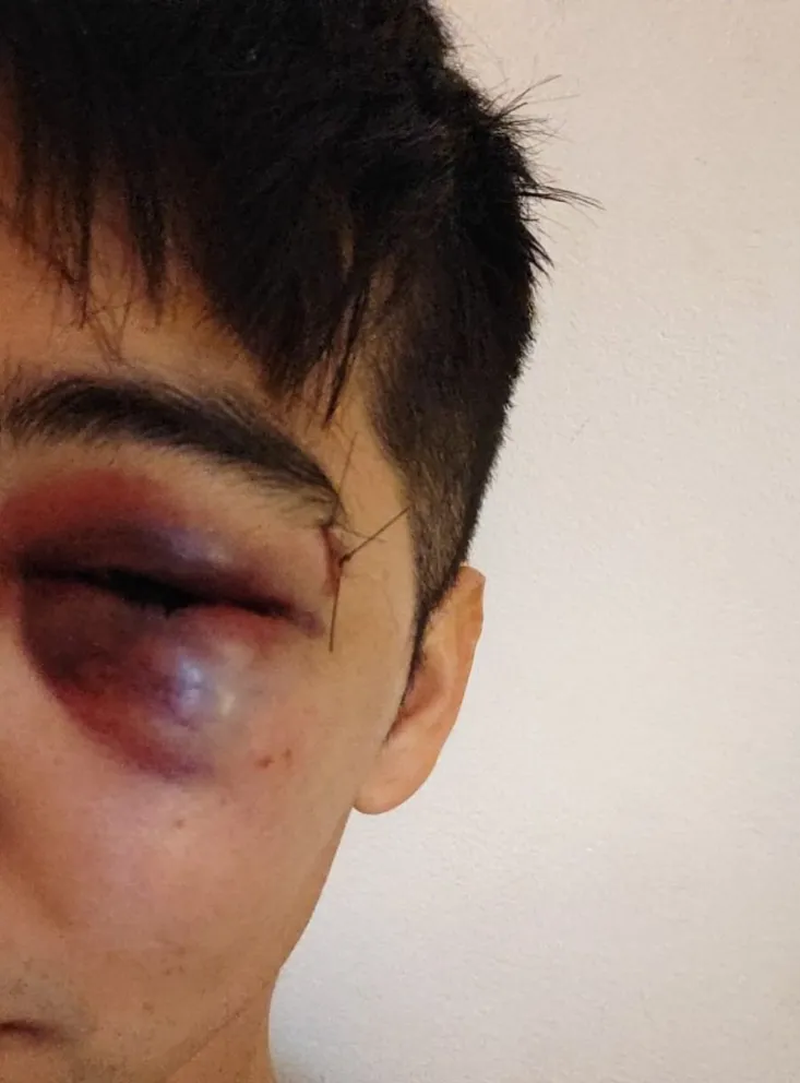 Un estudiante universitario recibió una golpiza por tirarle agua a un perro