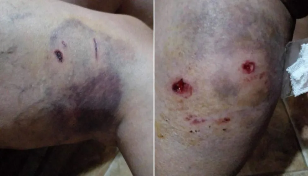 Bestial ataque de perros a una vecina de Viedma: un pelotero funciona cerca