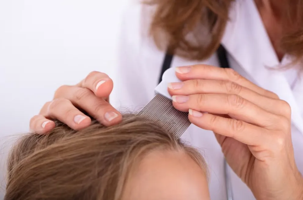 Volvieron las clases, volvieron los piojos y hay prevención