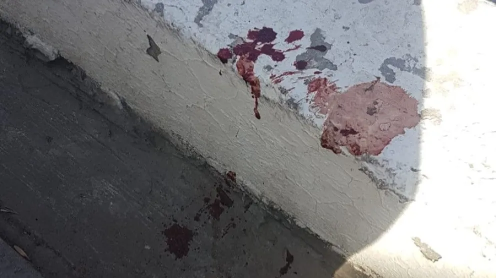 Tropezón y susto en un supermercado de Viedma