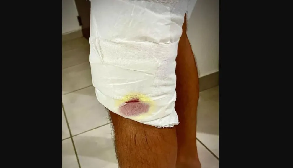 Hay preocupación y piden soluciones urgentes.