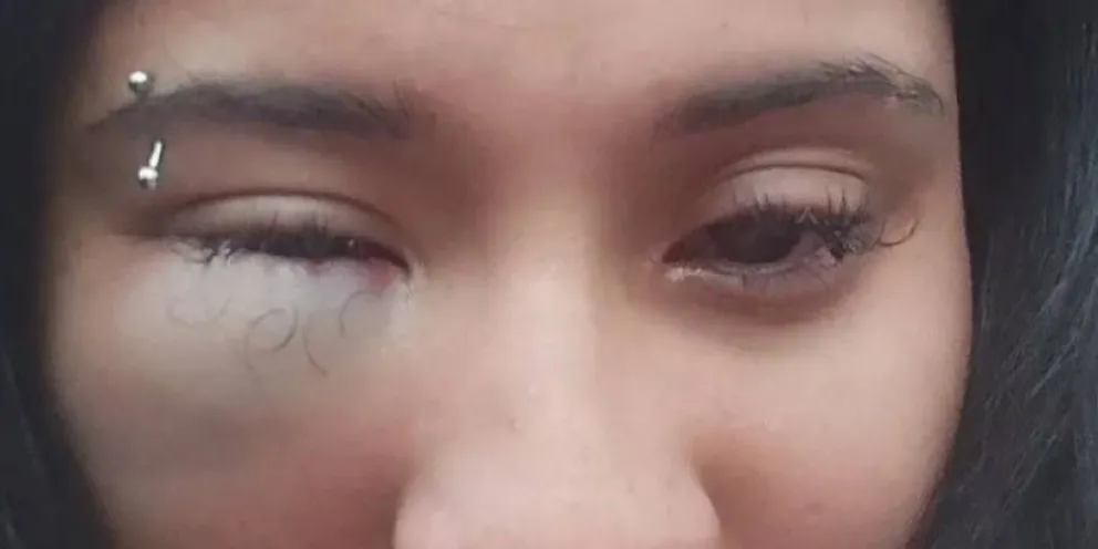 Sufrió violencia de género y la salvó una pareja que estaba cerca. 