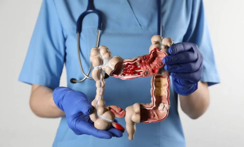 La detección temprana es crucial para aumentar las posibilidades de curación. 