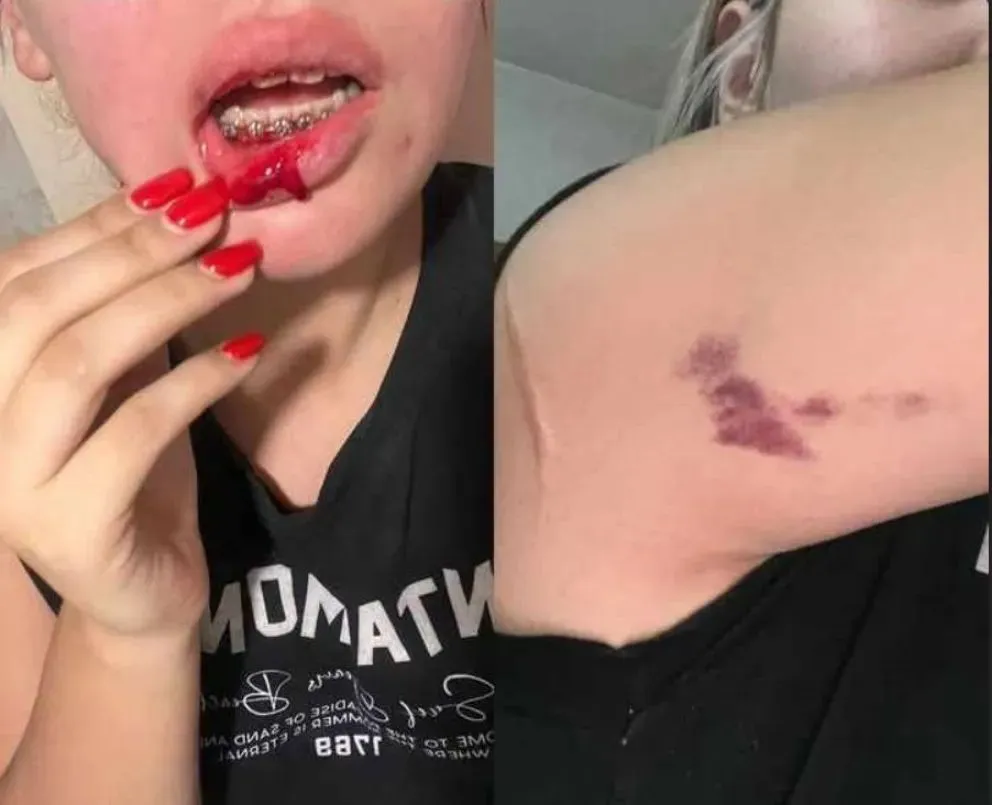 El agresor tenía una orden restricción a su domicilio. Era su expareja y padre de su hija. Foto: gentileza.