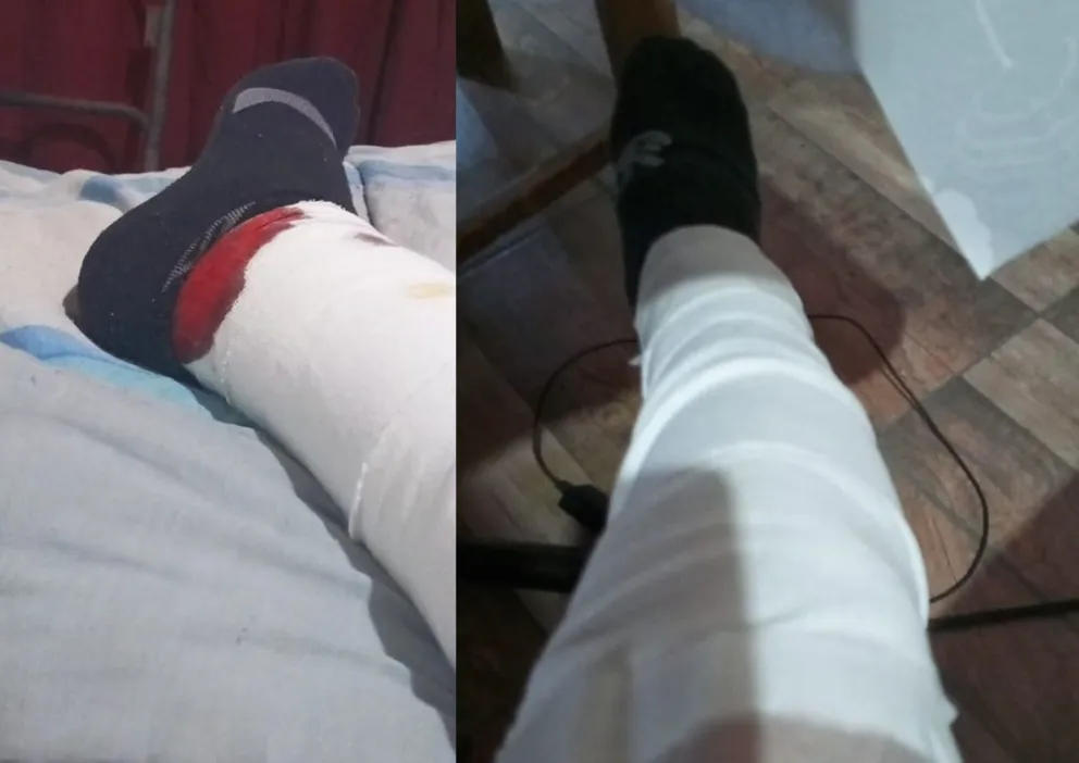 Así fueron las heridas del hombre atacado por los perros. 