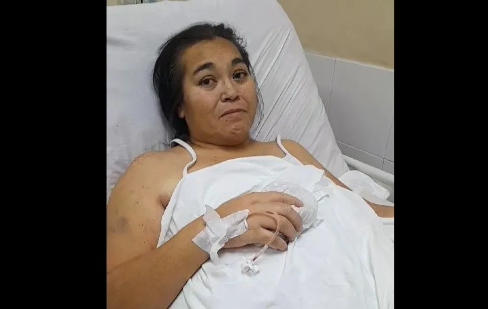 La mujer se encuentra internada en el hospital Artémides Zatti. 