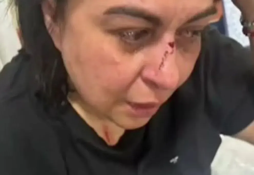 Vanina Lavaccara sufrió lesiones en el rostro y el brazo tras ser agredida en plena vía pública. La docente universitaria fue asistida por vecinos y atendida en un sanatorio local. Foto: gentileza