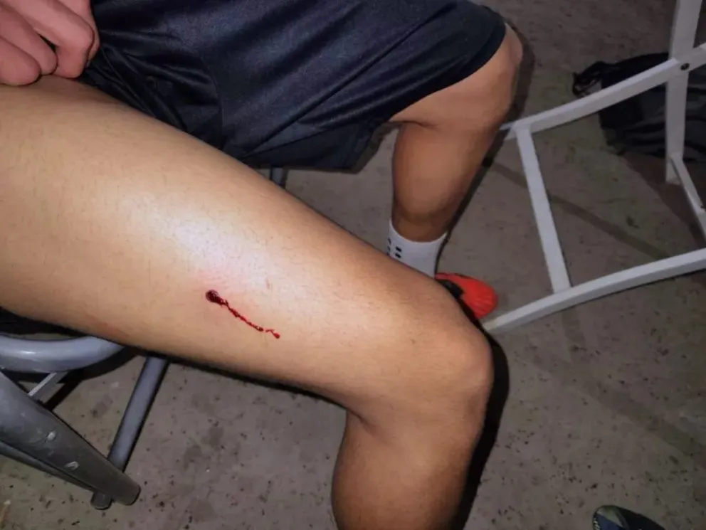 Uno de los jugadores recibió un disparo en una de sus piernas. Foto gentileza.
